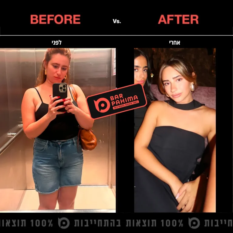 ליאם פדלון