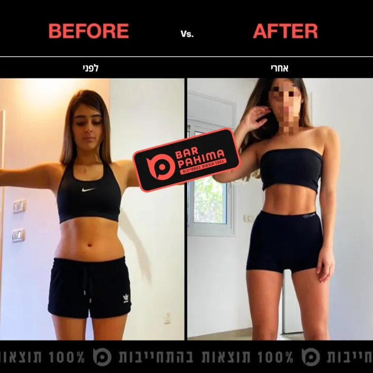 שירז איפרגן